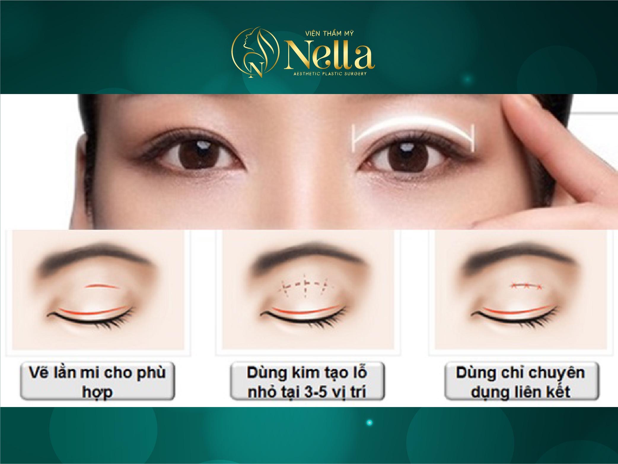 nhấn mí nella