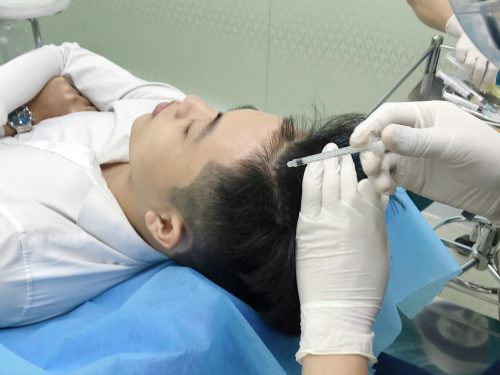 Điều trị rụng tóc kích thích thích mọc tóc Nella