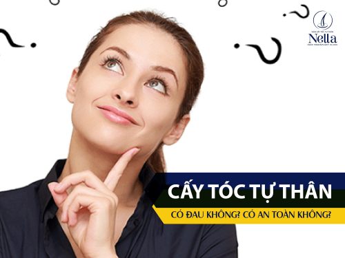 Cấy tóc tự thân có đau không
