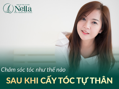 Cahmw sóc tóc như thế nào sau khi cấy tóc tự thân