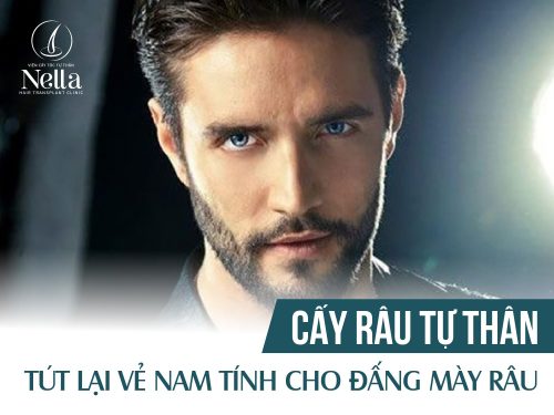 Cấy râu tự thân