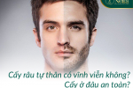 Cấy râu tự thân có vĩnh viễn không? Cấy ở đâu an toàn?